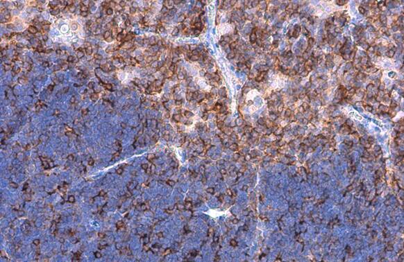 Plastin L Antibody