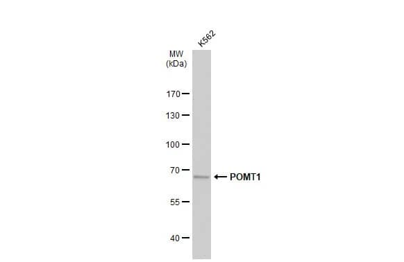 POMT1 Antibody