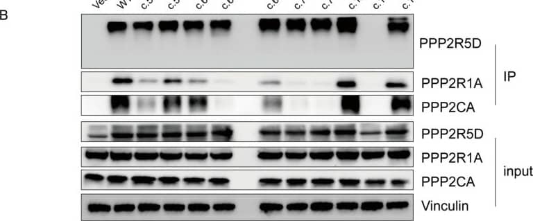 PPP2R1A Antibody - BSA Free