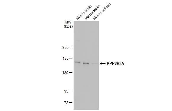 PPP2R3A Antibody