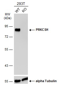 PRKCSH Antibody