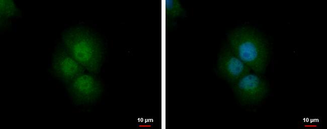 PRMT2 Antibody