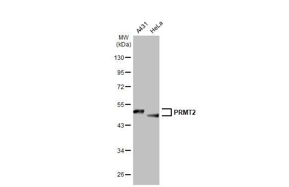 PRMT2 Antibody