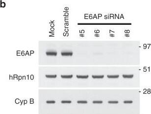 S5a/Angiocidin Antibody