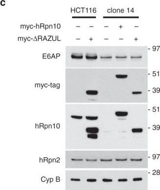 S5a/Angiocidin Antibody