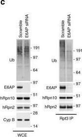 S5a/Angiocidin Antibody