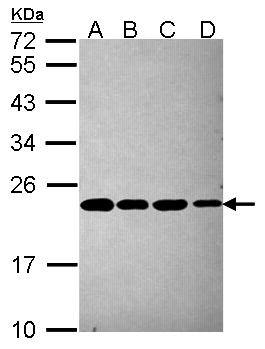 PSMB5 Antibody