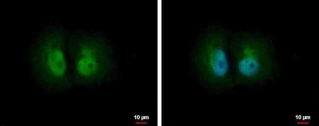 PA28 Activator alpha Subunit/PSME1 Antibody