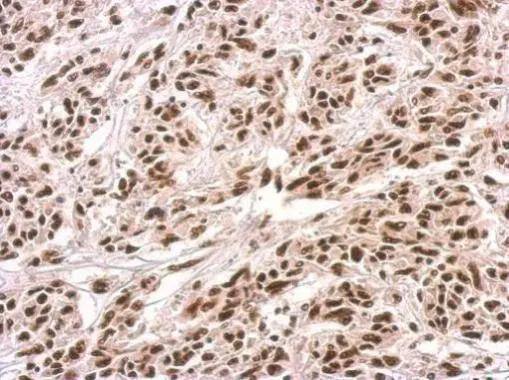 PUF60 Antibody