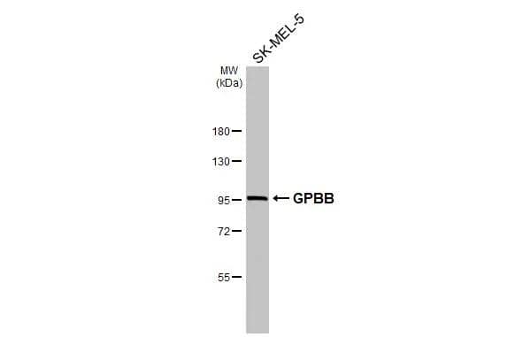 Glycogen Phosphorylase BB/GPBB Antibody - BSA Free