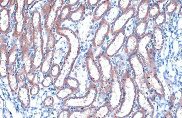 RAB35 Antibody