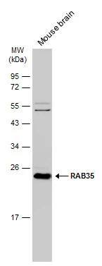 RAB35 Antibody - Azide Free
