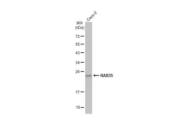 RAB35 Antibody - Azide Free