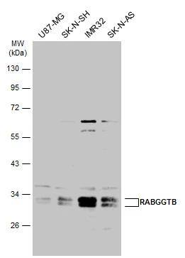 RABGGTB Antibody