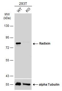 Radixin Antibody