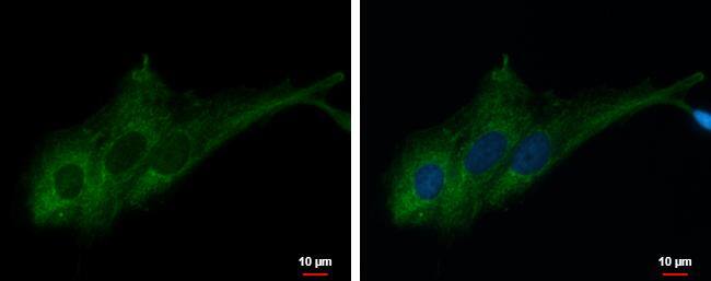 RASA3 Antibody - BSA Free