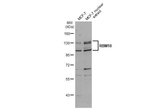 RBM10 Antibody