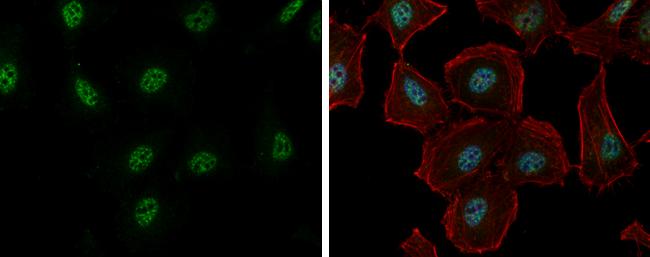 RBM26 Antibody - BSA Free