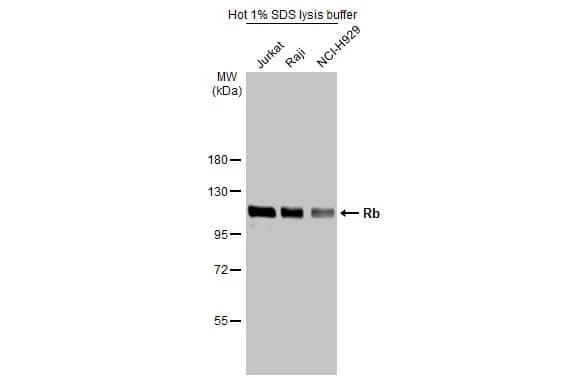 RB1 Antibody
