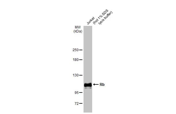 RB1 Antibody