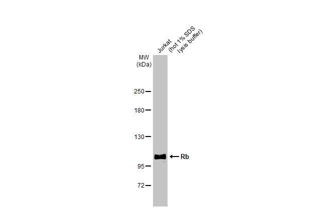 RB1 Antibody - BSA Free