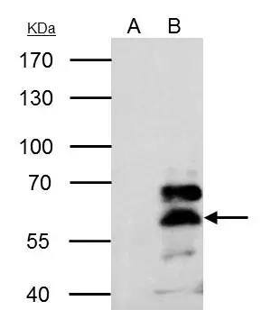 RXR alpha/NR2B1 Antibody
