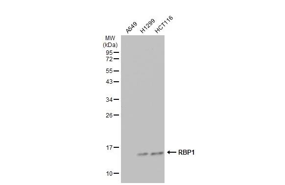 Retinol Binding Protein RBP Antibody
