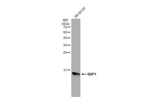 Retinol Binding Protein RBP Antibody