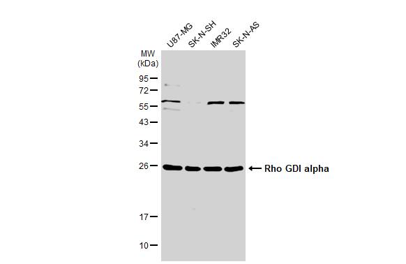 RhoGDI Antibody