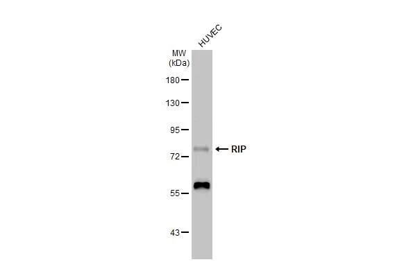 RIPK1/RIP1 Antibody