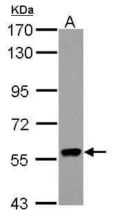 RIPK2 Antibody