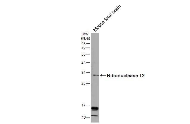 RNASET2 Antibody - BSA Free