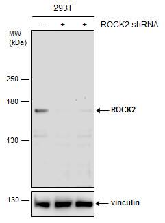 ROCK2 Antibody - BSA Free