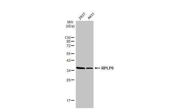 RPLP0 Antibody - BSA Free