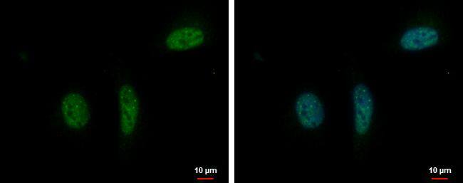 RPRD1B Antibody - BSA Free