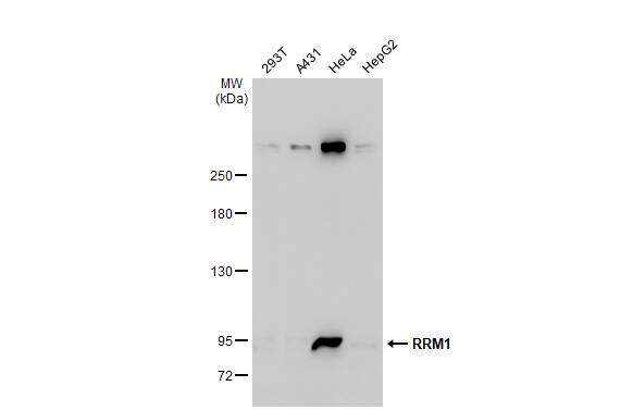 RRM1 Antibody