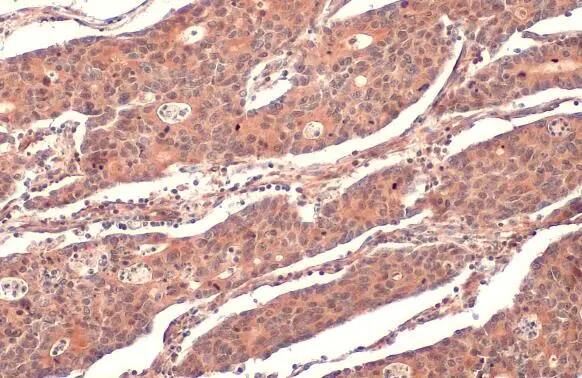 RRM1 Antibody
