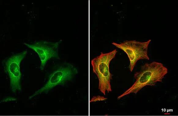 RRM1 Antibody
