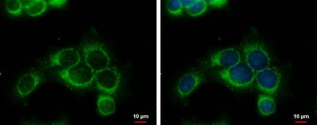 RRM1 Antibody - BSA Free