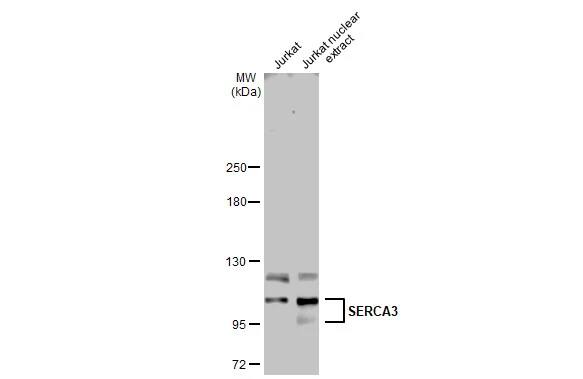 SERCA3 ATPase Antibody