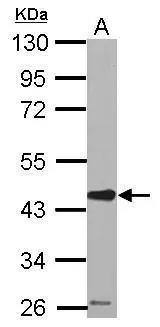 Serpin E2/PN1 Antibody