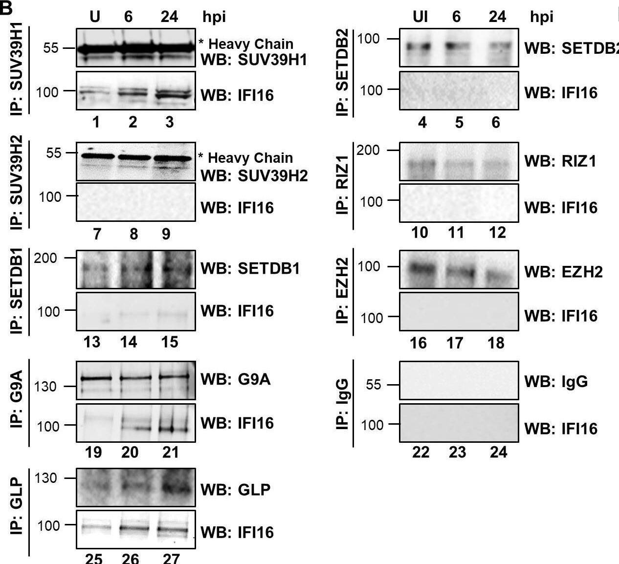 SETDB1 Antibody - BSA Free
