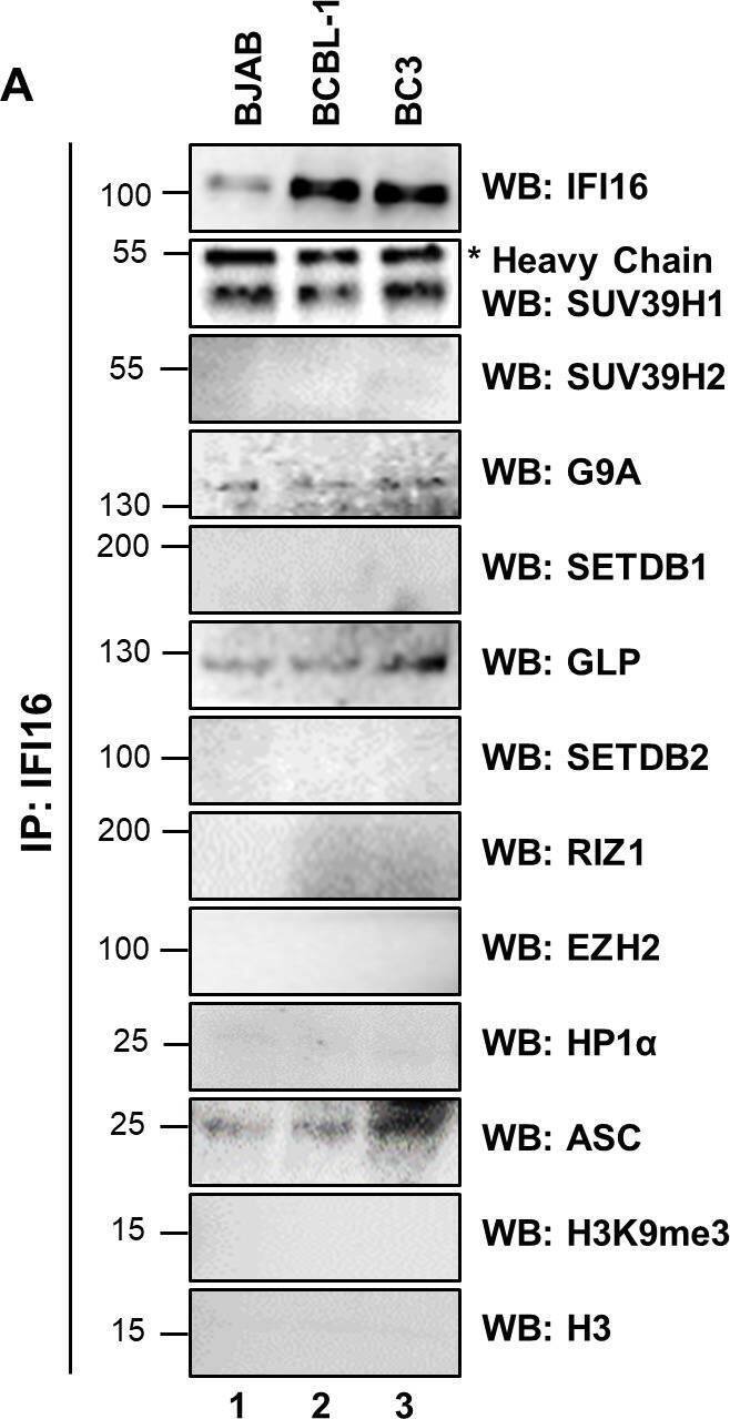 SETDB1 Antibody - BSA Free