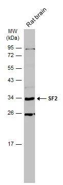 SF2 Antibody