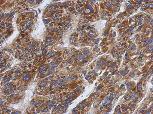 SFXN1 Antibody - BSA Free