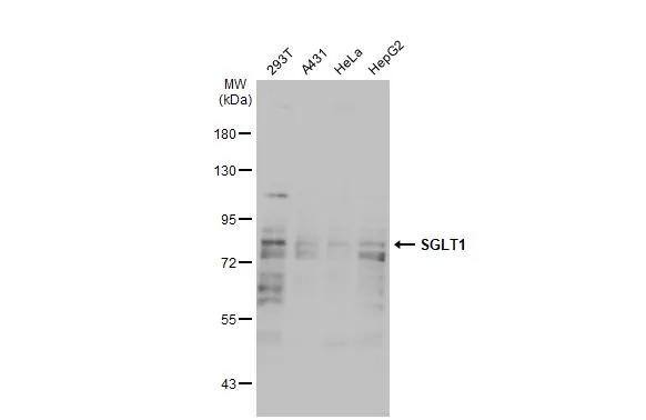 SGLT1/SLC5A1 Antibody - Azide Free