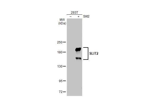 Slit2 Antibody - BSA Free