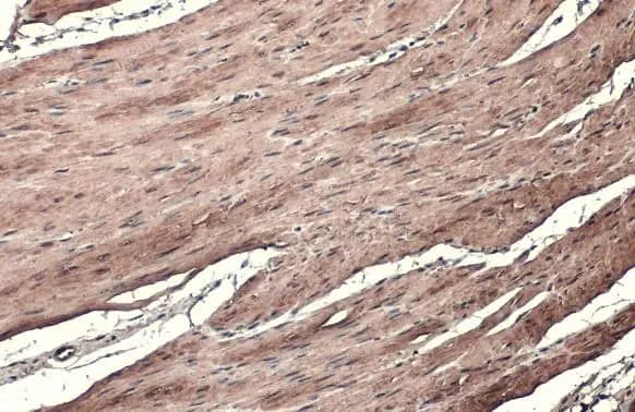 Transgelin/TAGLN/SM22 alpha Antibody