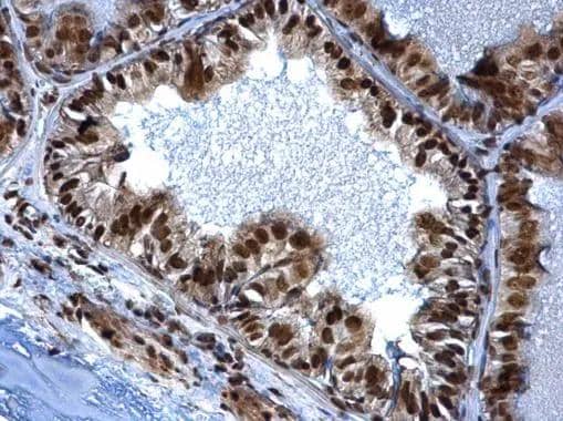 SMARCC1 Antibody - BSA Free