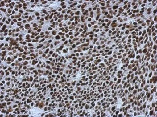 SMARCC1 Antibody - BSA Free
